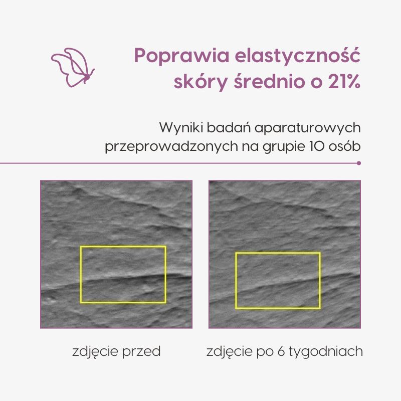 Krem pod oczy z DMAE_Mawawo_badania aparaturowe_zdjęcie 1
