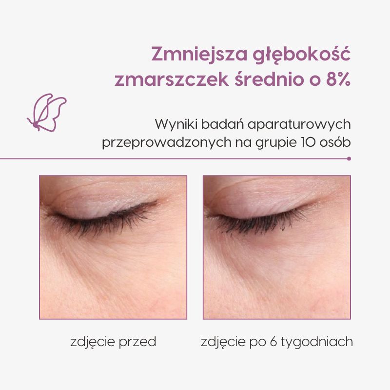 Krem pod oczy z DMAE_Mawawo_badania aparaturowe_zdjęcie 2