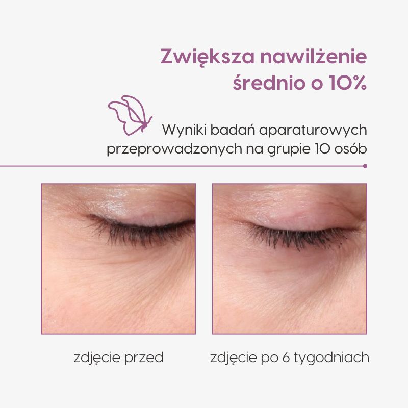 Krem pod oczy z DMAE_Mawawo_badania aparaturowe_zdjęcie 3