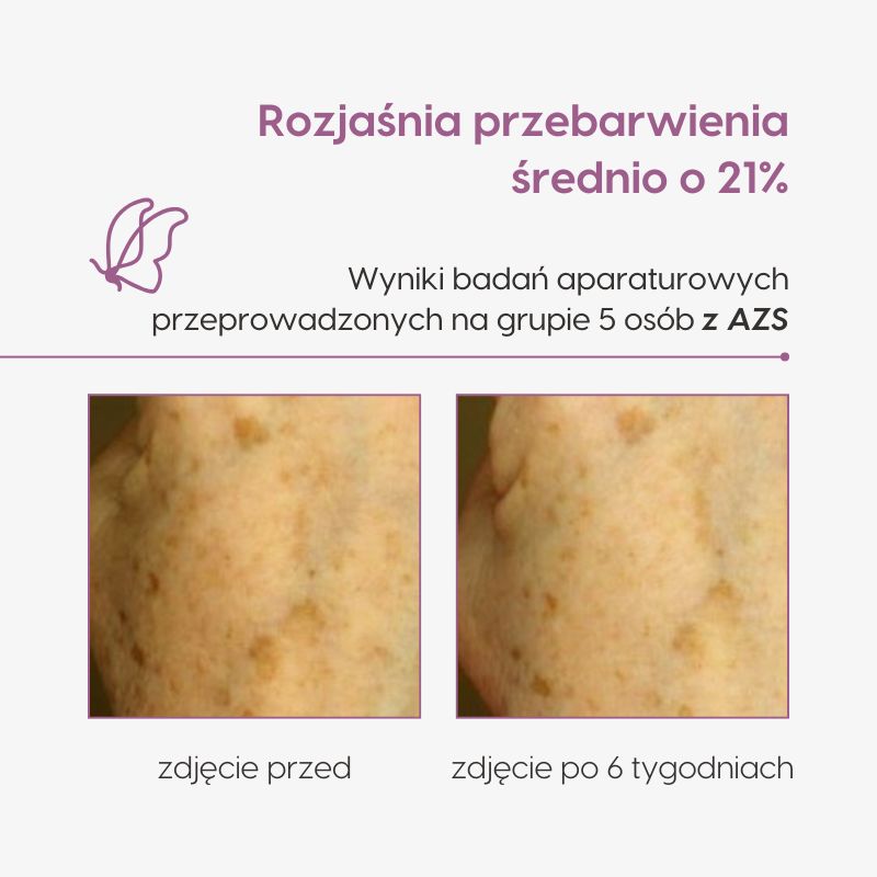 Laktobionowy krem do rąk_Mawawo_badanie