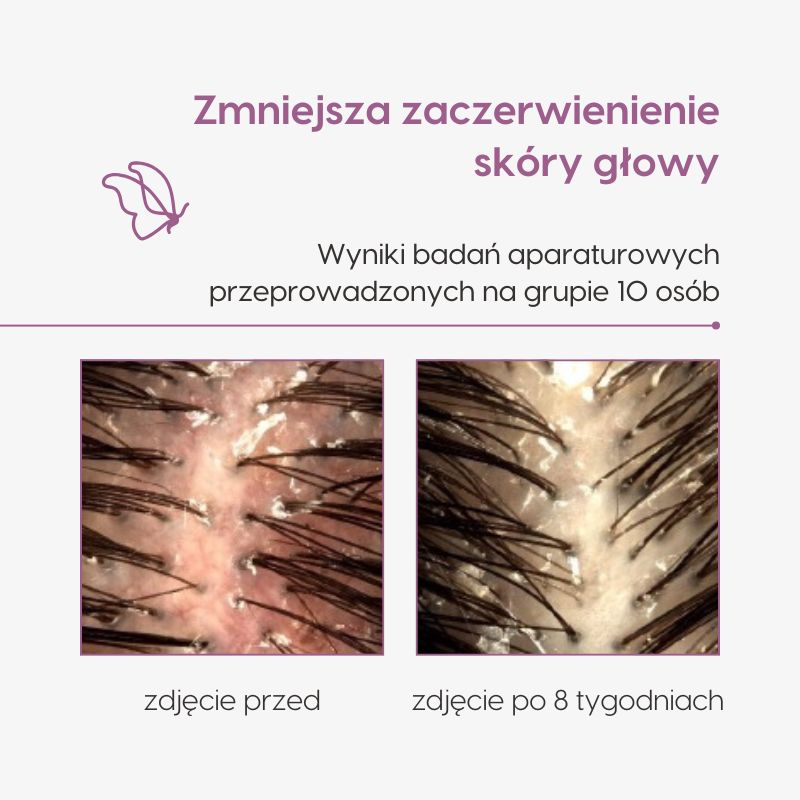 Lotion przeciw wypadaniu włosów_Mawawo_Badania