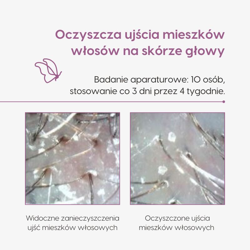 Oczyszczająco-nawilżająca maska do skóry głowy_Mawawo_Wyniki badań