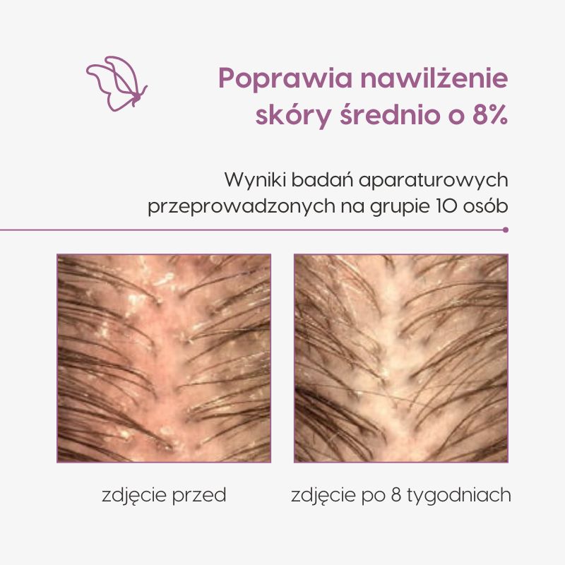 Laktobionowy peeling do skóry głowy_Mawawo_Wyniki badań