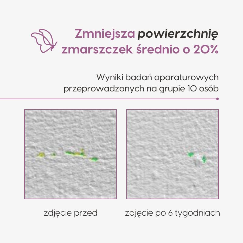 Intensywnie odżywczy krem do twarzy_Mawawo_badania aparaturowe