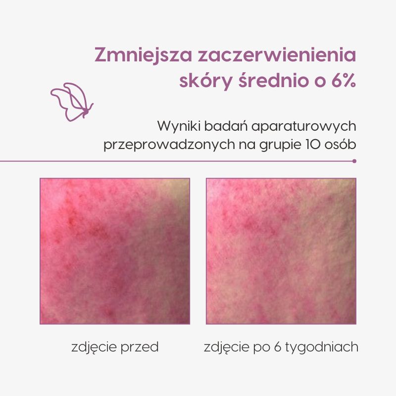 Kompleksowy krem odmładzający z retinalem i drożdżami_Mawawo_badania aparaturowe