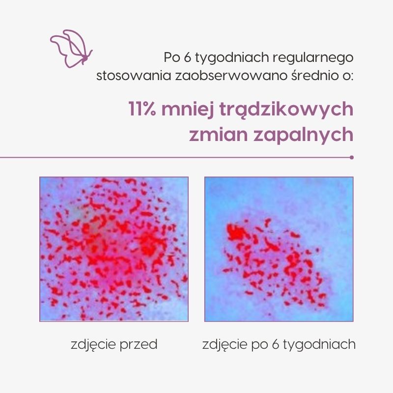 Krem o potrójnym działaniu do pielęgnacji skóry mieszanej_Mawawo_badania aparaturowe_wyniki badań