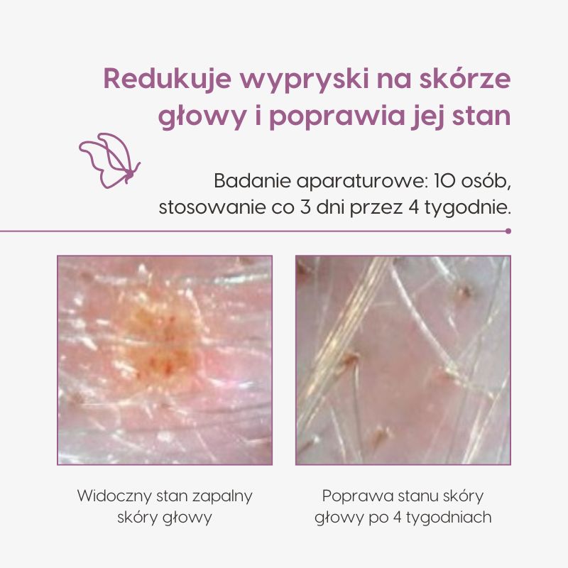 Oczyszczająco-nawilżająca maska do skóry głowy_Mawawo_Badania